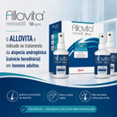Allovita 50mg/ml - Minoxidil - Solução Capilar 5% 50ml