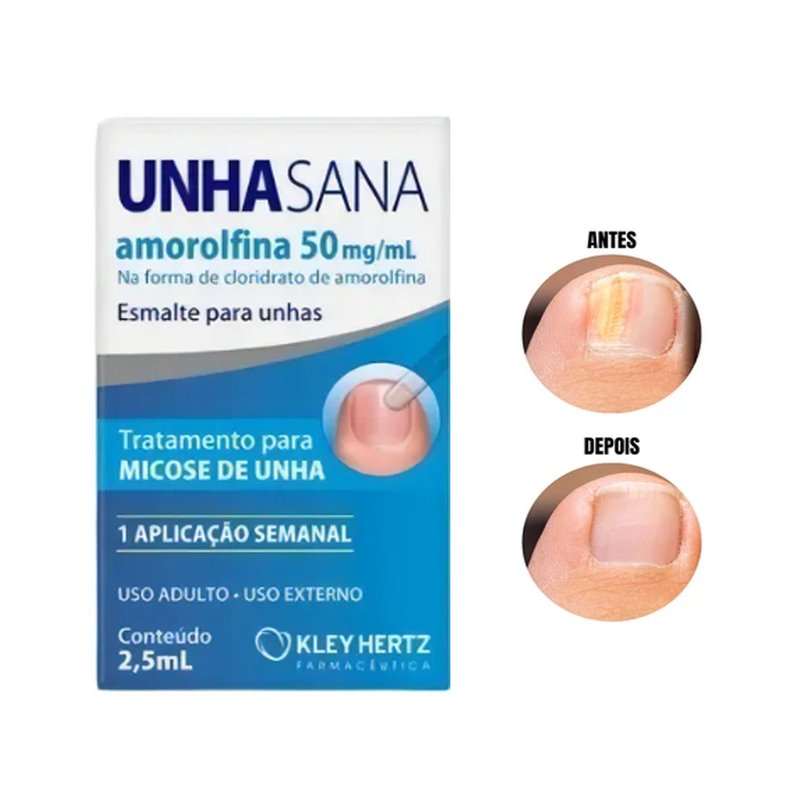 Tratamento para Micose - Esmalte Unha Sana 2,5ml